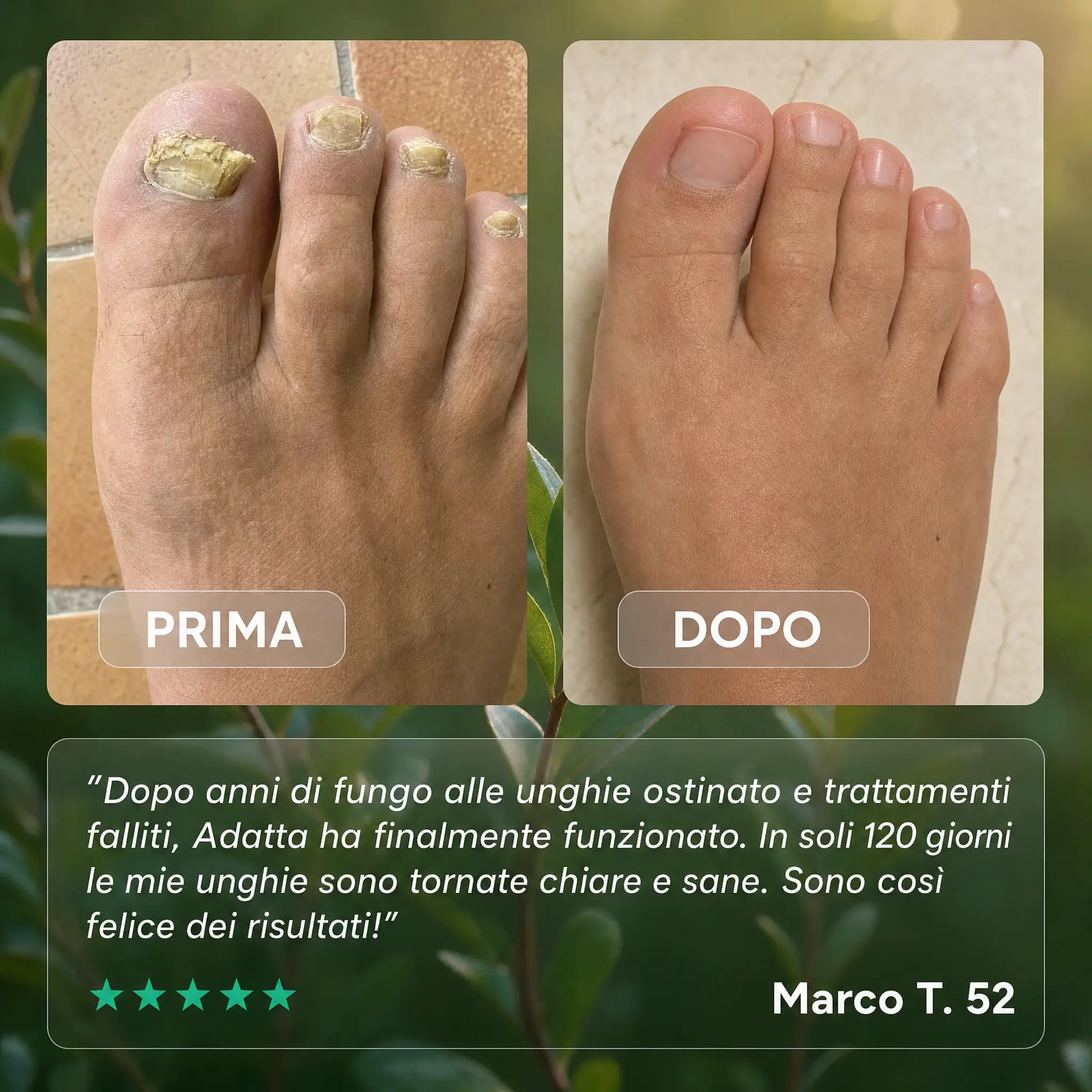 Penna Trattante per Piede d'Atleta